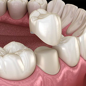 Dentist in Kitty Hawk